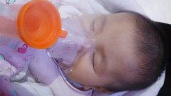 宝宝使用压缩雾化器吸入治疗技巧分享